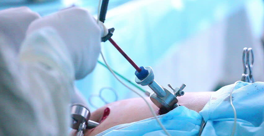 Arthroscopy Treatment vs. Traditional Surgery: Which is Better?