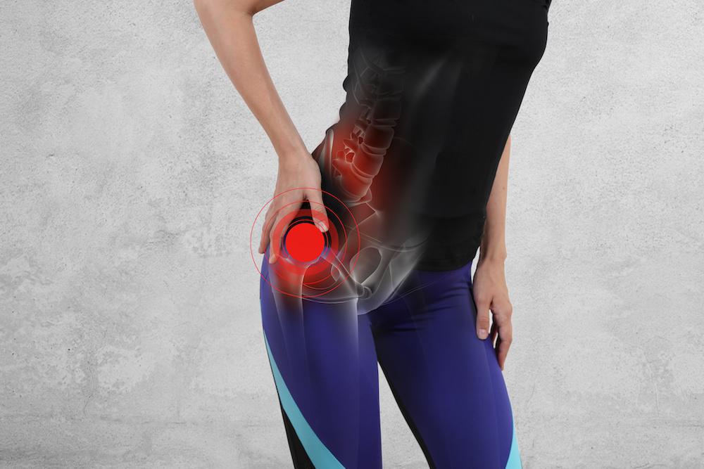 Causes of Hip Pain And Conditions That Require Hip Replacement