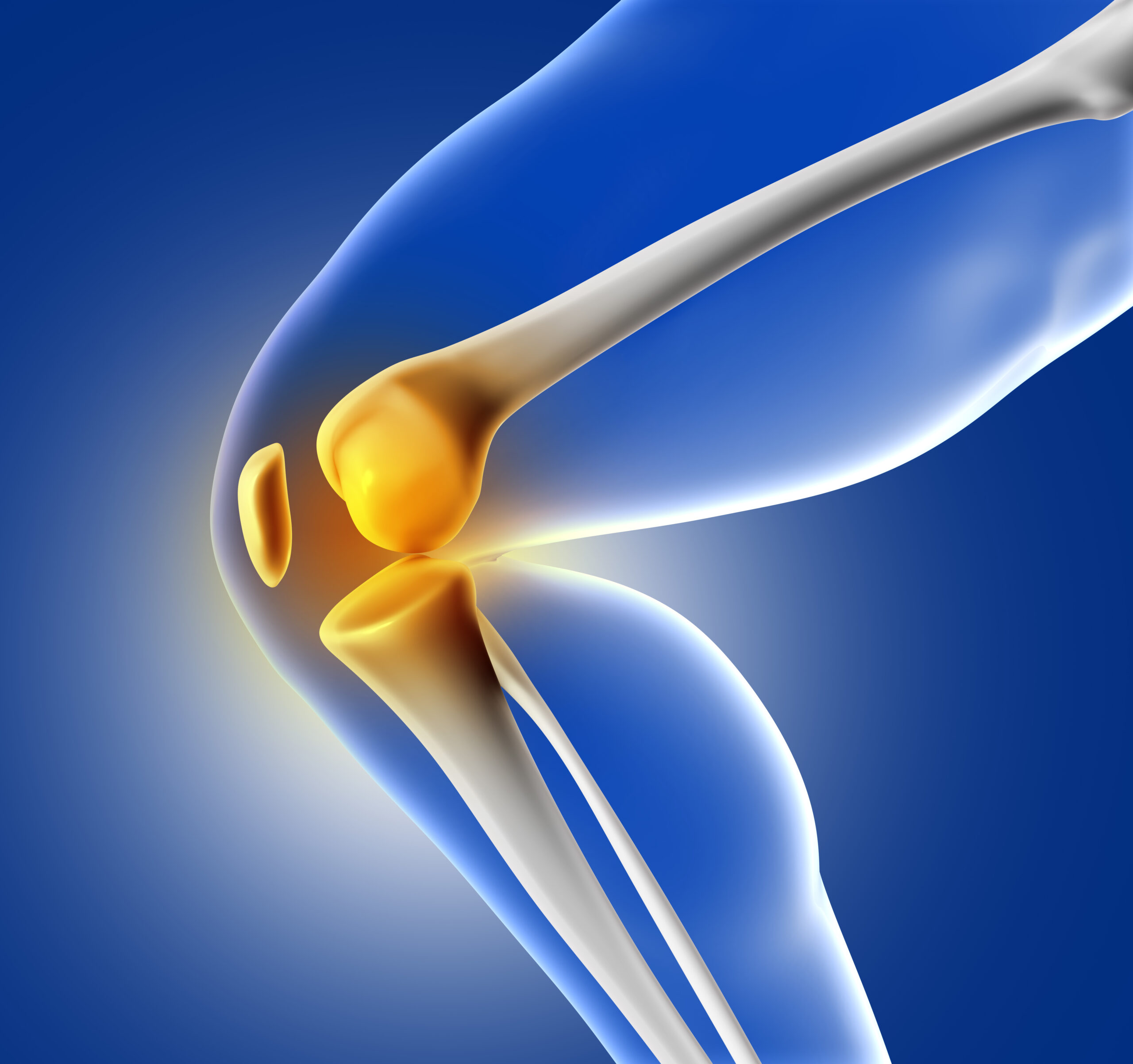 Best Knee Replacement Surgeon in Pune