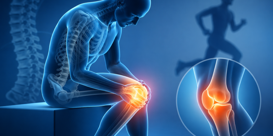 3D medical illustration of a person holding a painful knee joint with highlighted inflammation in a blue clinical background